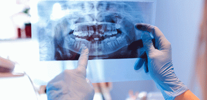 Blomqvist, Woolley - Filling the Cavities in Canada’s Dental Coverage