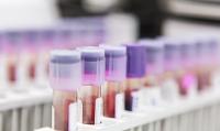 What the Doctor Ordered: Improving the Use and Value of Laboratory Testing